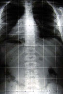 Radiografia Addome